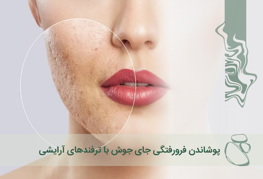 پوشاندن فرورفتگی جای جوش با ترفندهای آرایشی